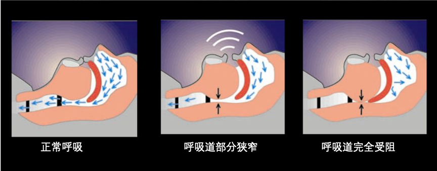 睡眠知识